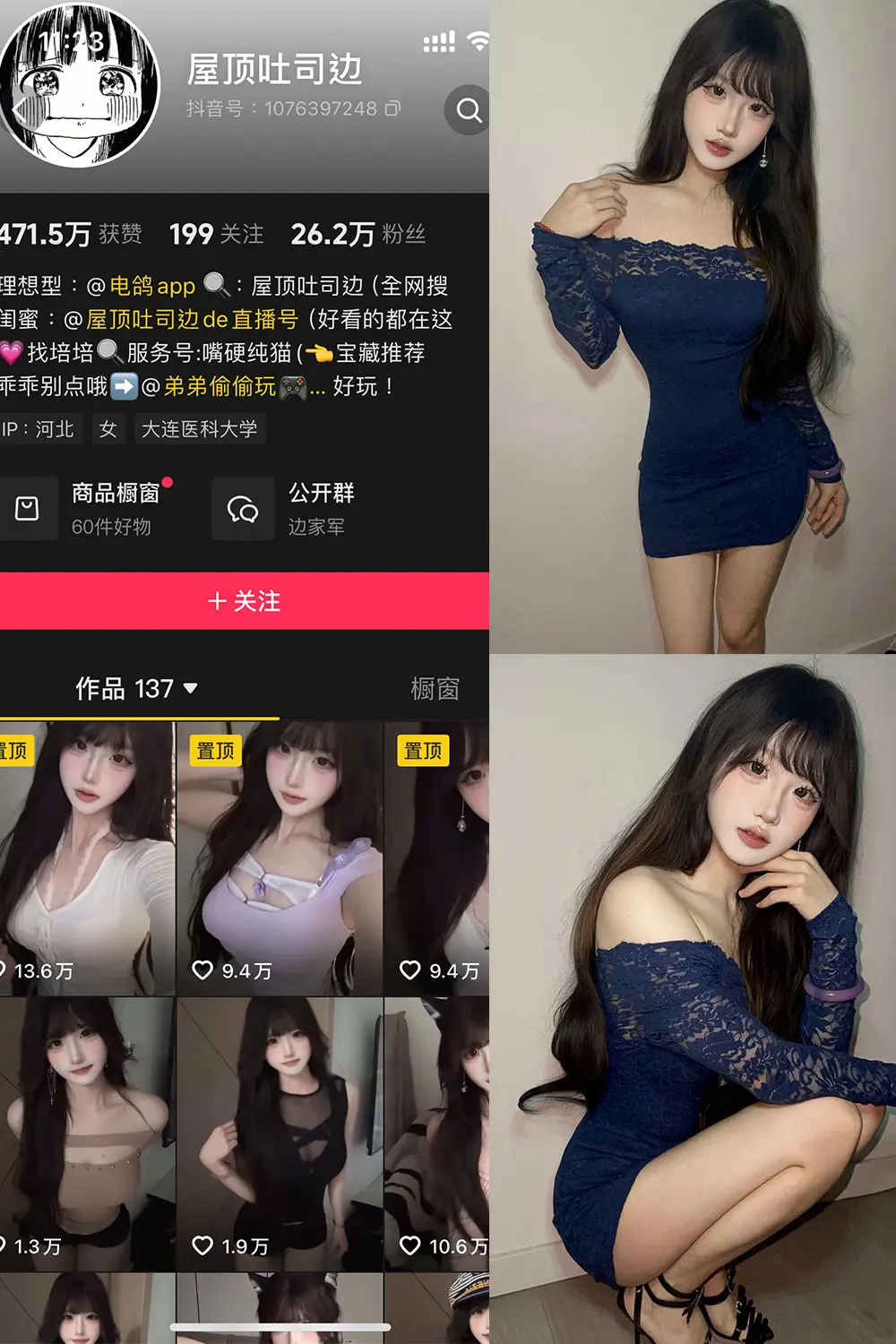 抖音 屋顶吐司边 岛遇 NO.001期 【10P11V】-尤坊沐